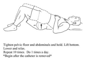 Post Prostatectomy Excercises - Urology San Antonio