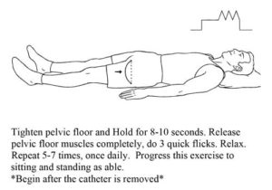 Post Prostatectomy Excercises - Urology San Antonio